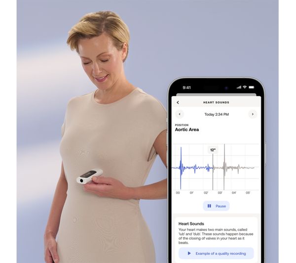 Withings BeamO - Portable 4-in-1 Health Monitor ECG, Stethoscope, SpO2 & Temperature | 78-SCT02-02-All-Int